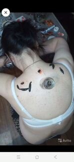 Пиявки медицинские